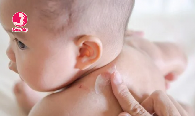 Có nên dùng kem dưỡng ẩm cho trẻ sơ sinh ?
